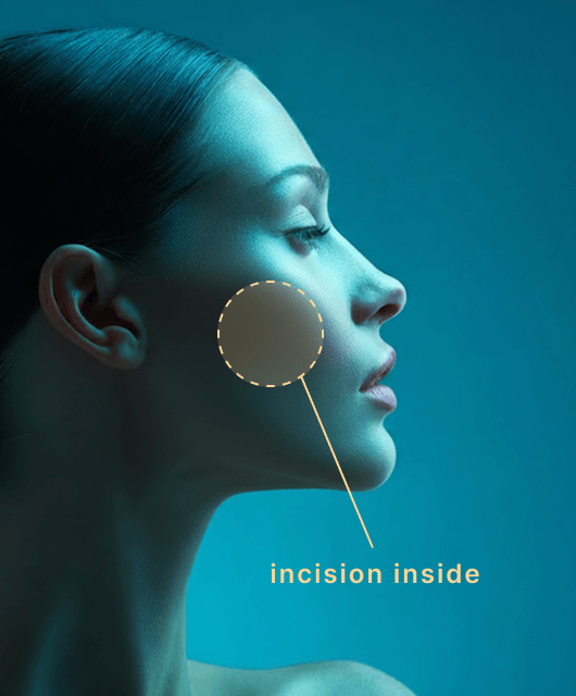 Buccal Fat Removal