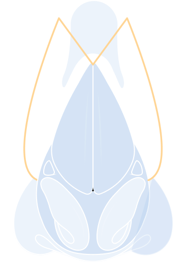 Revision Rhinoplasty